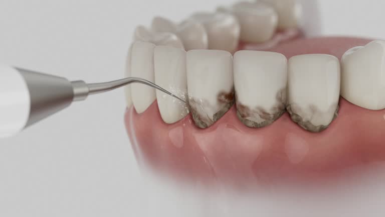Trusted Wisdom Tooth Removal service in El Cerro Mission, NM - Dentist Open Now